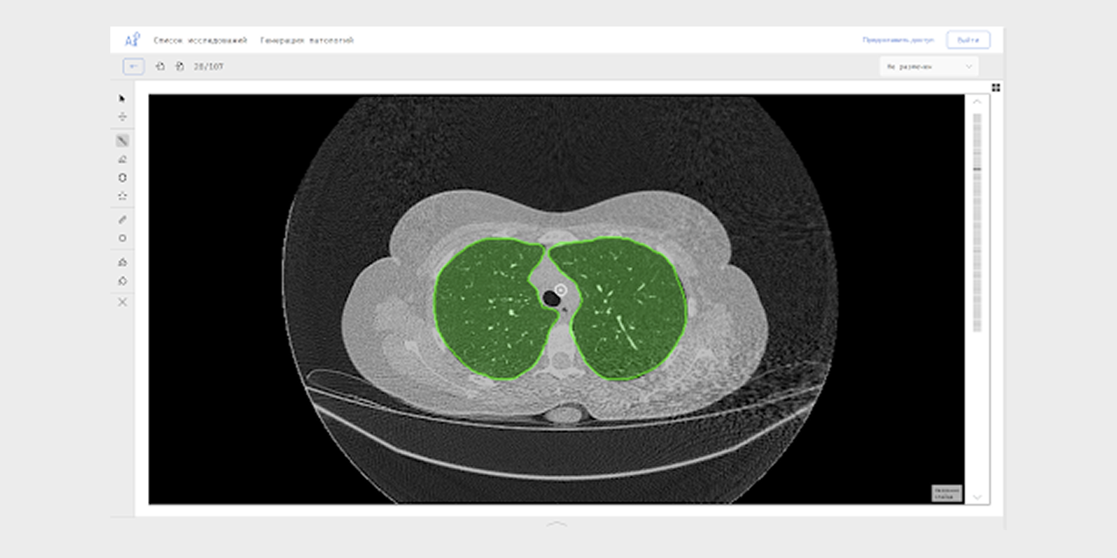 Medtech project interface preview
